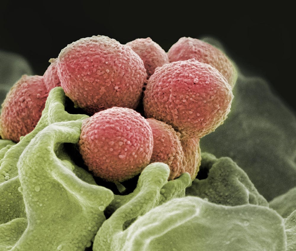 Will You Get FleshEating Bacteria Visiting Anna Maria Island? Probably