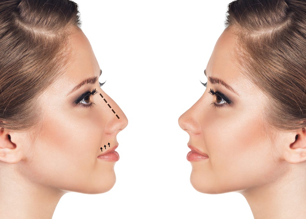 Rhinoplasty: Know All About Procedures & its Benef