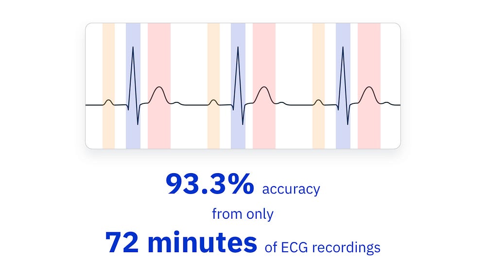 Deep Learning for ECG Interpretation - Powerful Medical
