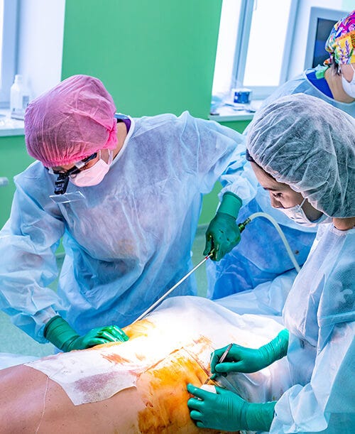 Hip Fat Removal Surgery Try This Cosmetic Procedure To Get Rid By 