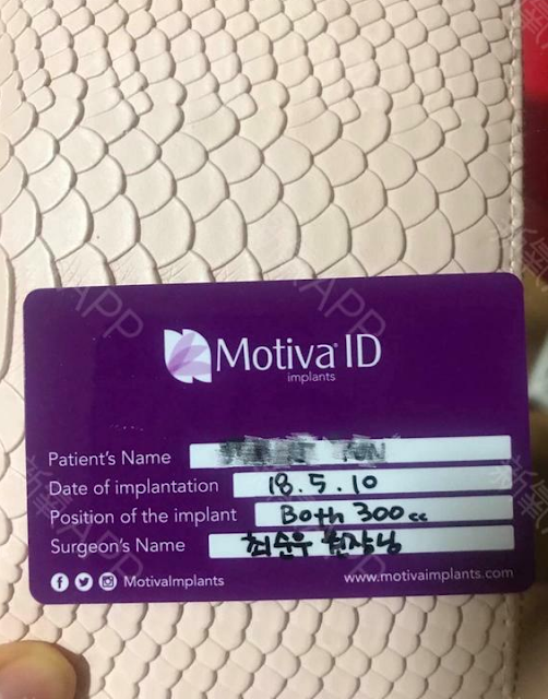 Breast Implant Id Card