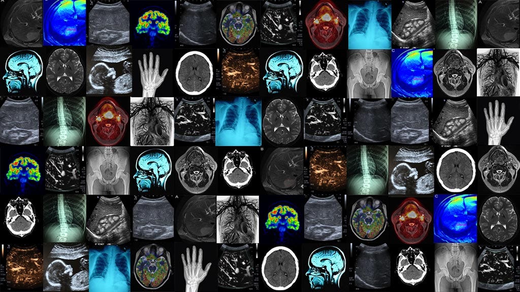 Deep Learning for Medical Imaging &amp; Healthcare | NanoNets