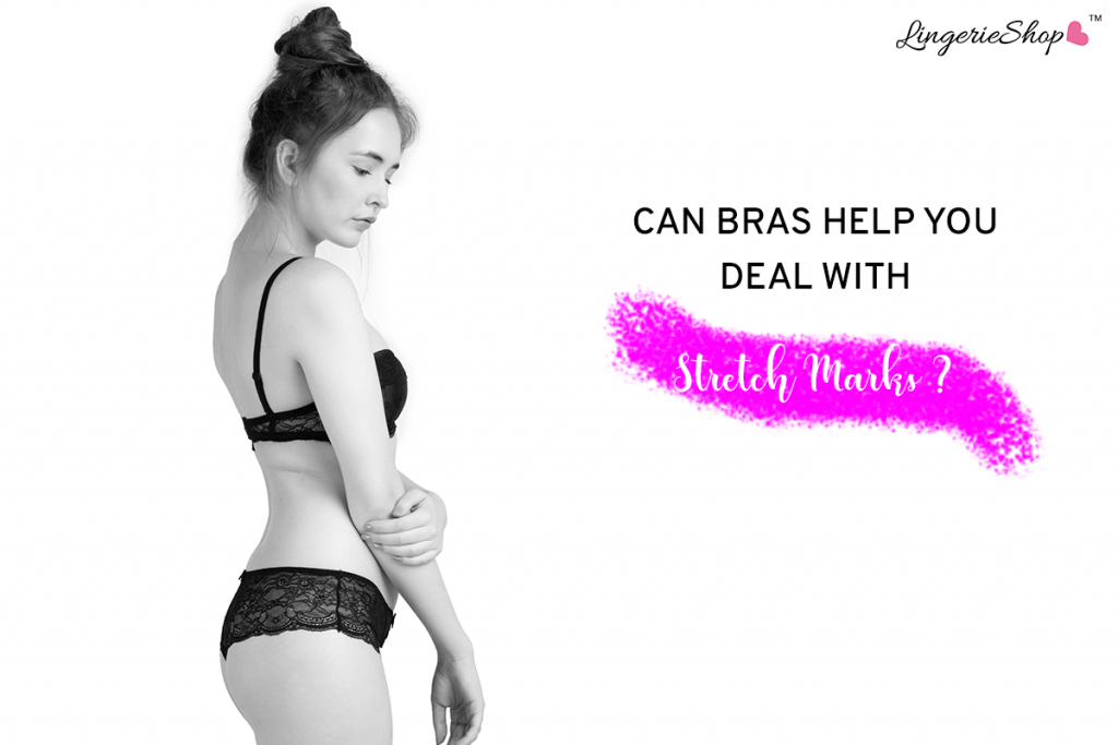 Can Bras Help You Deal With Stretch Marks By Vishal A Medium