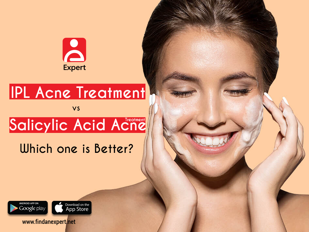 ipl acne