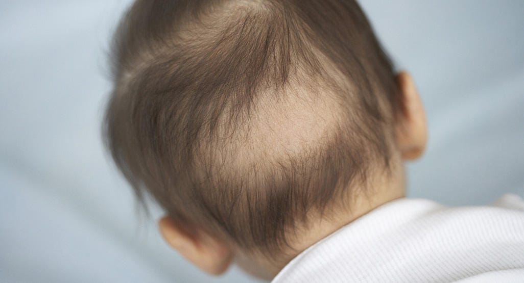 Causes of hair loss in children