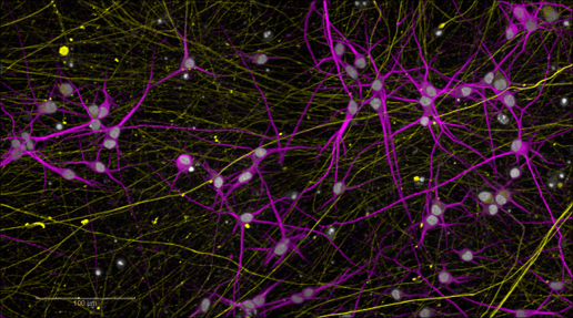 Stem cell-derived neurons in purple and yellow on a black background. Image credit: Barry McCarthy