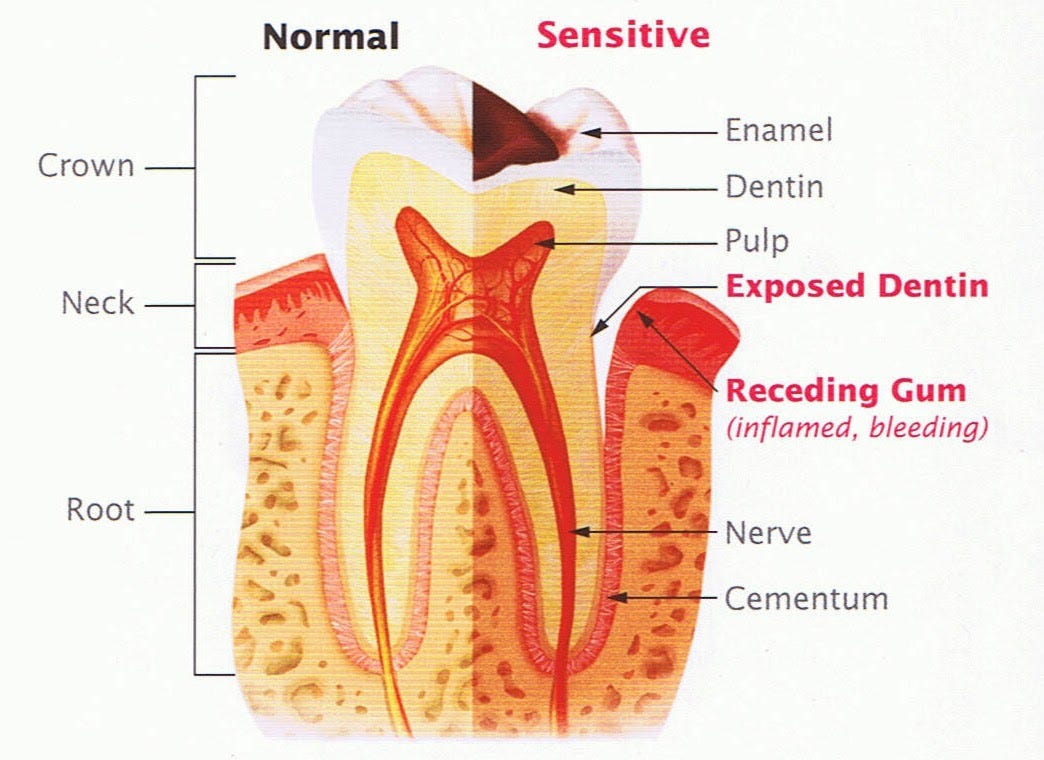 How winter causes tooth sensitivity and toothache by Dental Implants Cost Medium