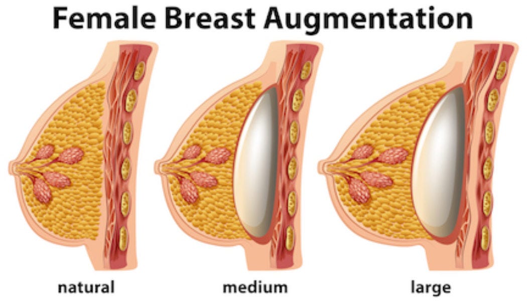Austin Tx Breast Implants