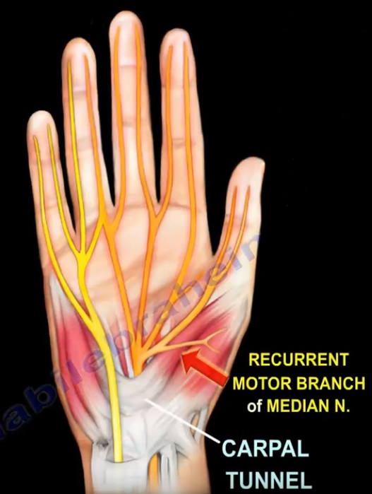 Ganglion Cyst Pressure Motor Branch of the Median Nerve | by Nabil