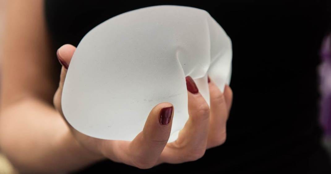 What is Breast Implant Illness?. More than 400,000 women undergo breast… |  by MedTruth | Medium