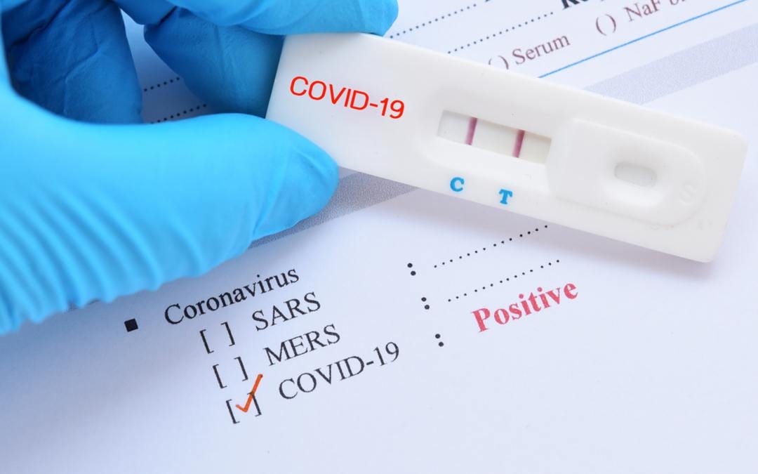 10 Things You Should Do When You Test Positive For COVID-19 | by MFinecare | Medium 10 Things You Should Do When You Test Positive For COVID-19 | by MFinecare | Medium