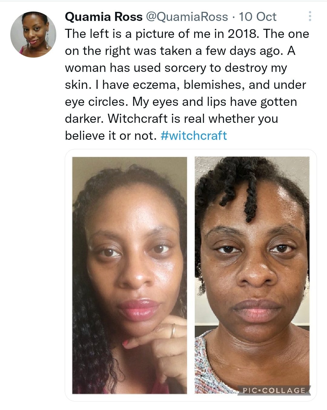 I Have A Real Life Stalker