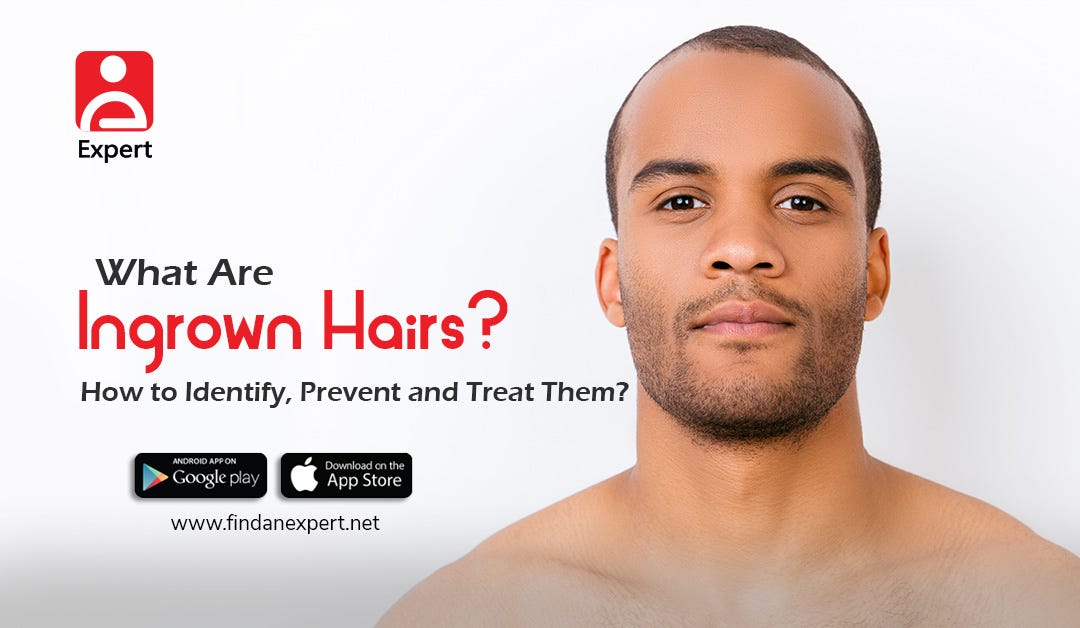 What Are Ingrown Hairs How To Identify Prevent And Treat Them