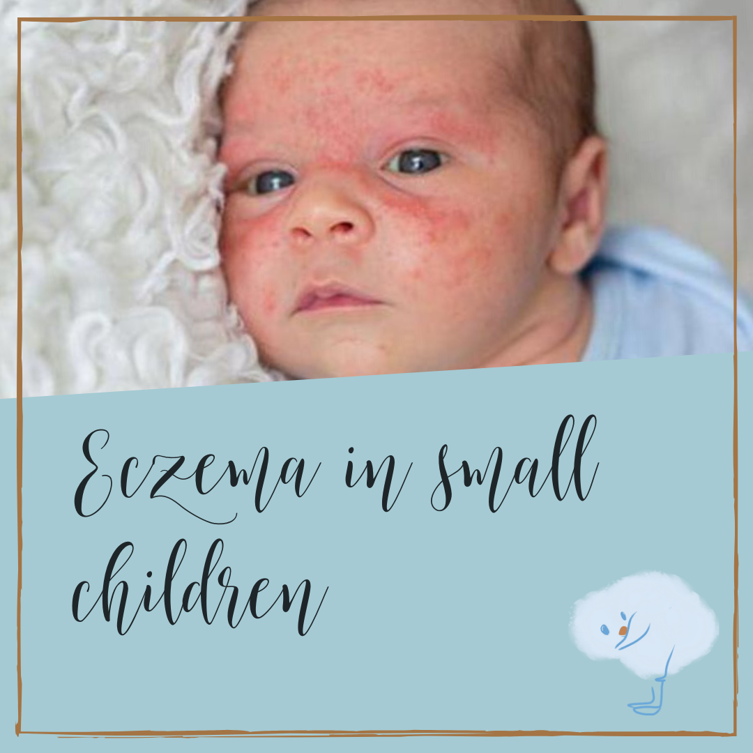 Eczema In Small Children. How common is eczema? | by Heidi Young | Medium