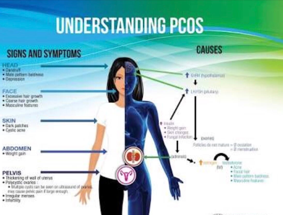 PCOS TREATMENT IMPROVES LADIES LIFE TODAY SCIENCE Medium