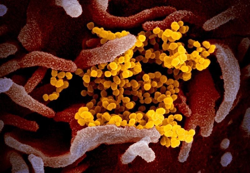 SARS virus mingled with human cells