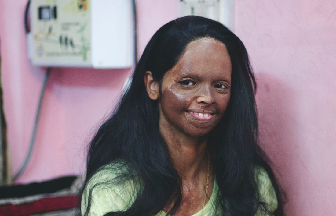 acid face