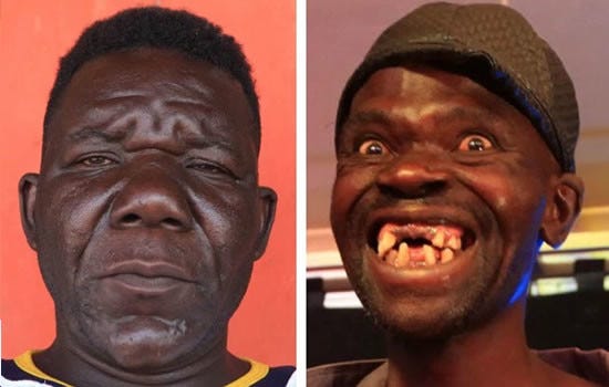Ele E Muito Bonito Para Ter Ganho O Titulo De Homem Mais Feio Do Zimbabwe By Ronaldo Matos Medium
