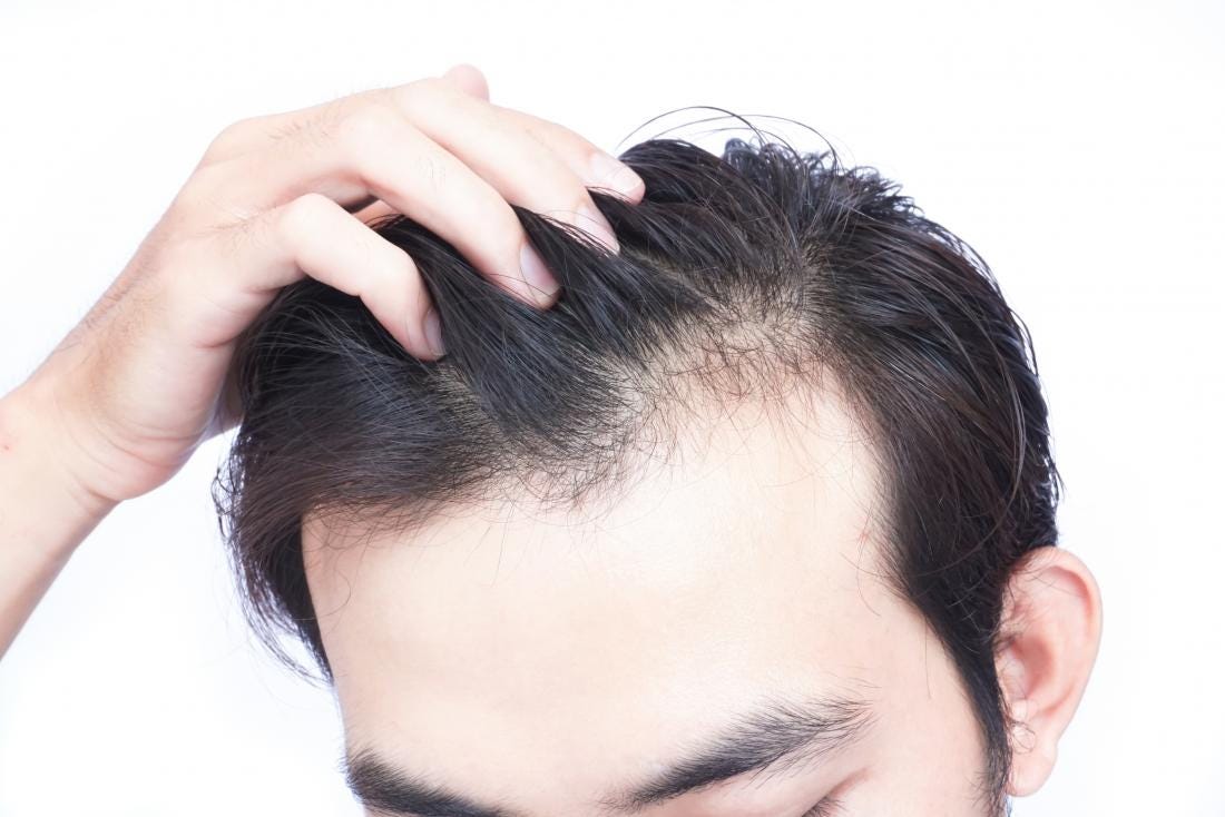 Thinking Of Hair Growth Treatment But Scared Of The Risk Go For
