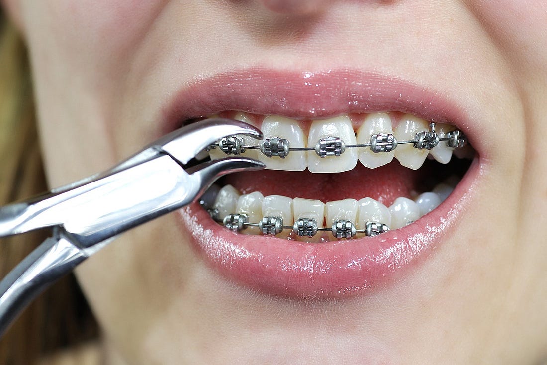 Gold Coast Orthodontics Provides Best Dental Care For People With