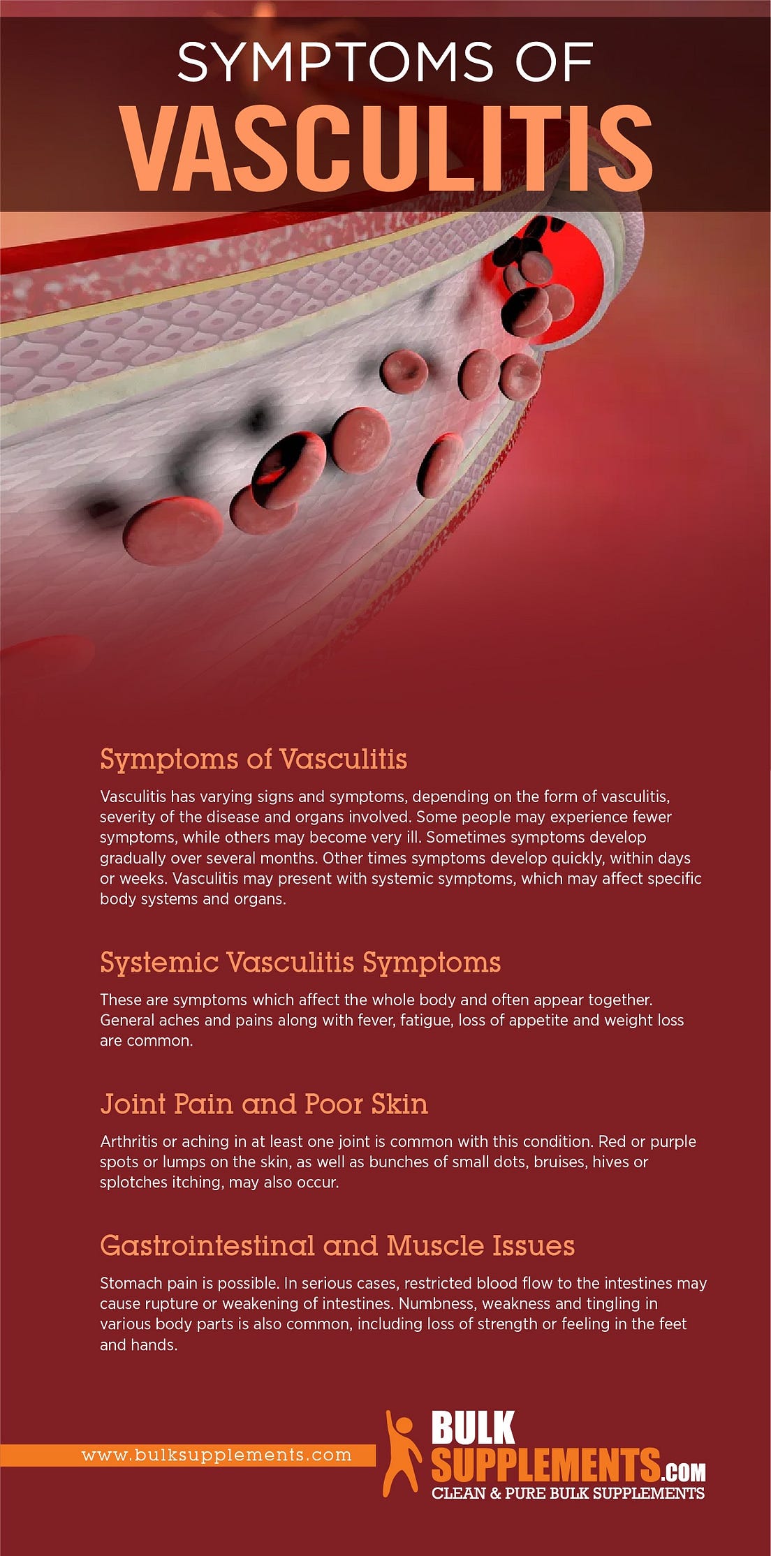 Vasculitis Symptoms Causes And Treatment By James Denlinger Medium 8972