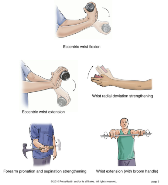 Tactical Recovery Guide for Wrist & Arm Repetitive Strain Injuries (RSI