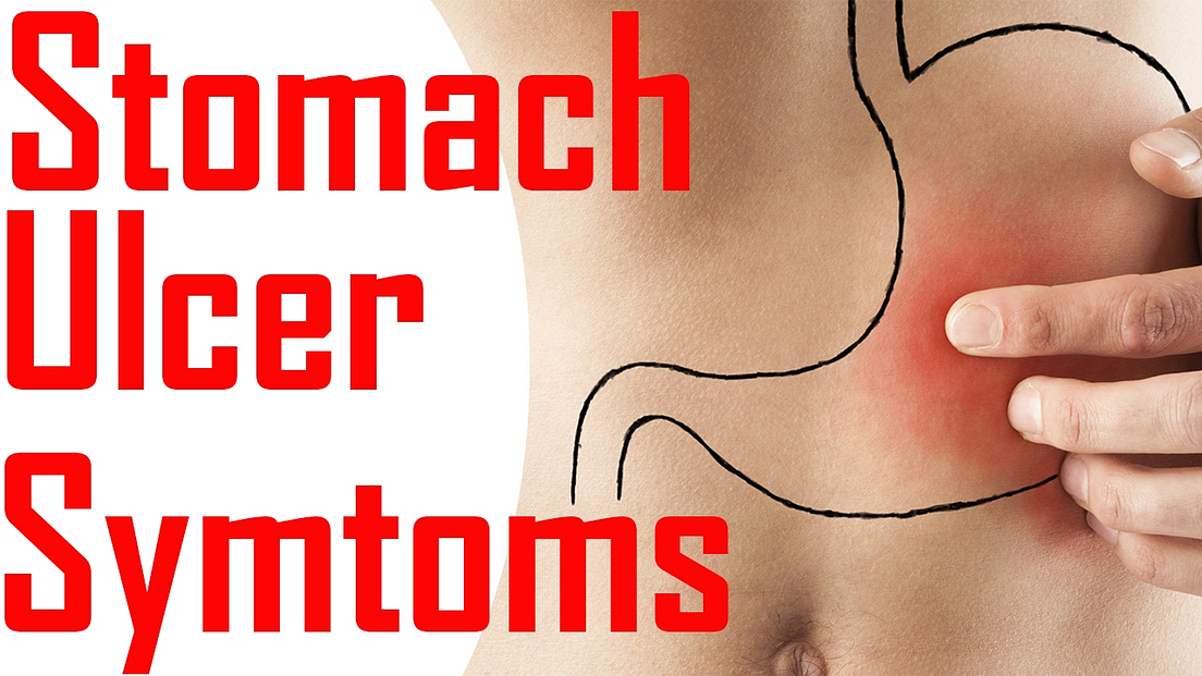 Lets Understand Stomach Ulcers There Is No Clear Evidence To Suggest