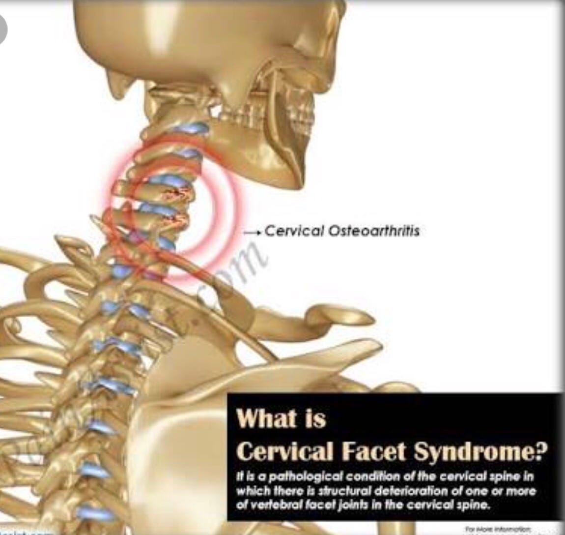 CERVICAL PROBLEM MANY OF US SUFFER FROM THIS AND DON’T KNOW ABOUT THIS