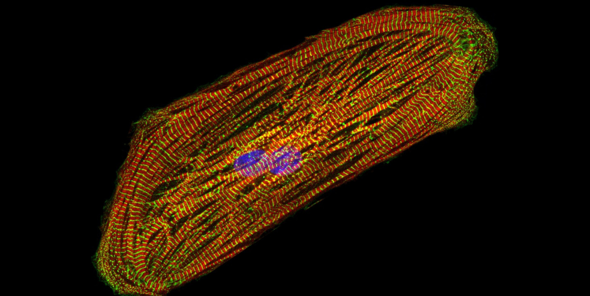 Existing Drug Found To Dampen Chemo Side Effects In Breast Cancer In A Dish By Stanford Medicine Scope Stanford Medicine Medium
