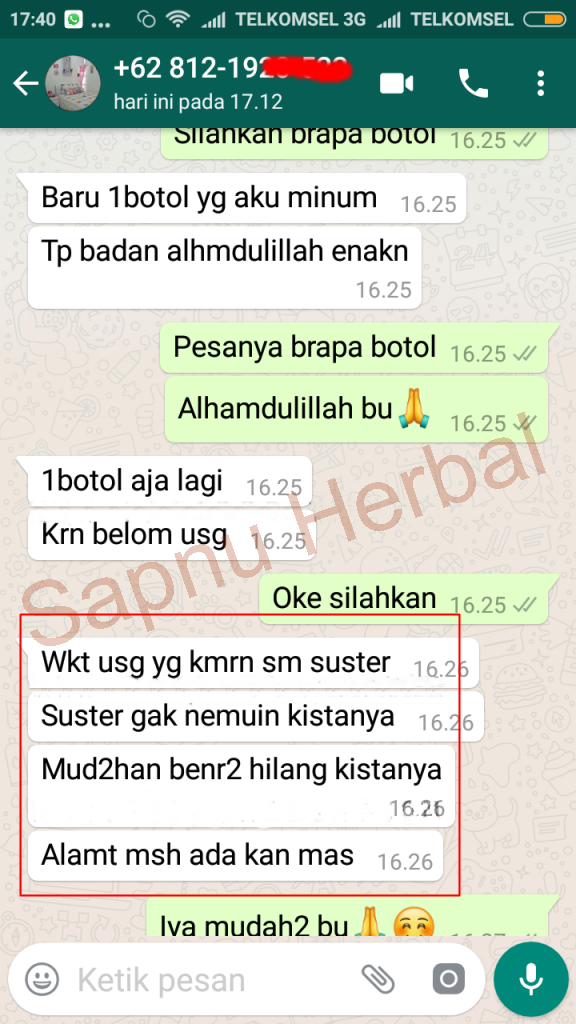Punya Benjolan Di Pergelangan Tangan Atau Kaki Mungkin Itu Punya Benjolan Di Pergelangan Tangan Atau Kaki Mungkin Itu