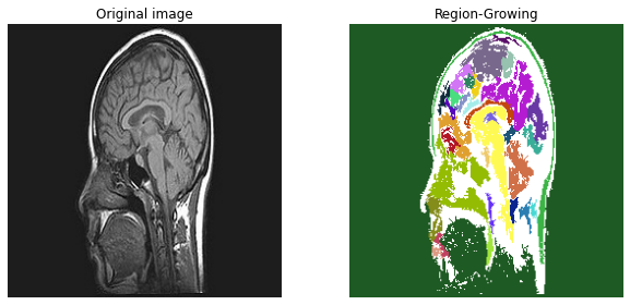 Introduction To Image Segmentation By Nabil Madali Towards Data Science