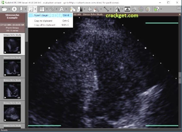 Radiant Dicom Viewer Crack V5 5 Serial Key Free Download By Hareem Shah Dec 2020 Medium