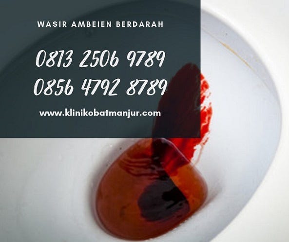 Cara Mengobati Wasir Berdarah Dengan Daun Sirsak Cara