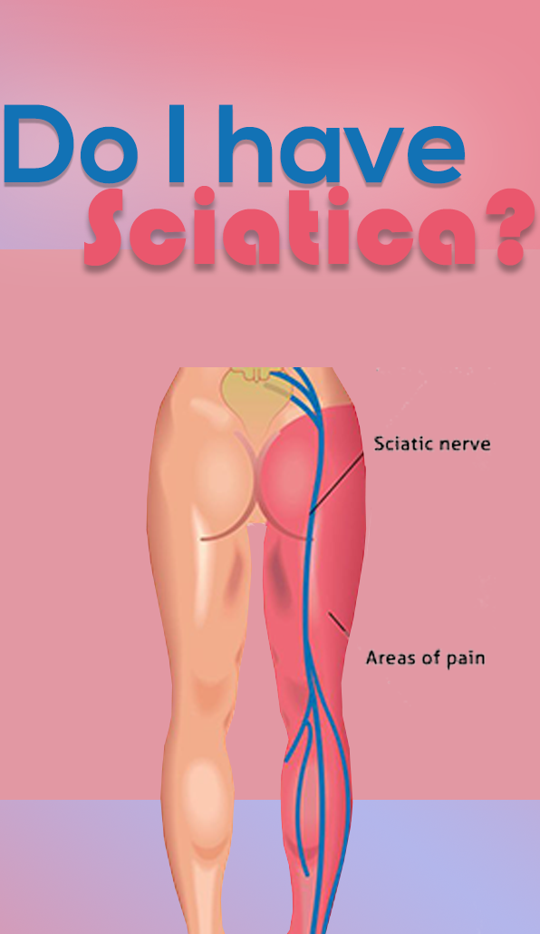 How Do I Get My Sciatic Nerve to Stop Hurting? | by Em ...