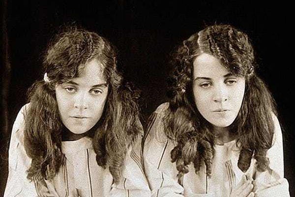 The Tragic Life Story Of The Conjoined Hilton Sisters By Sal Lessons From History Medium
