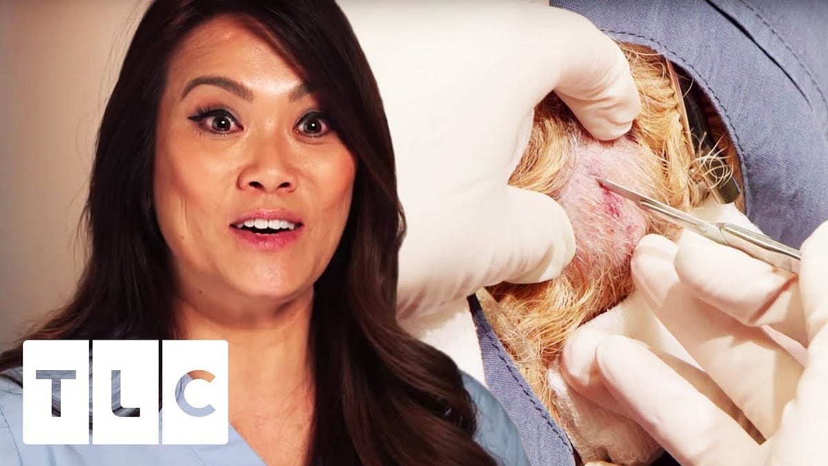 Dr. Pimple Popper Season 4 Episode 2 / Peh-DUN-kyoo-LAY-ted. 