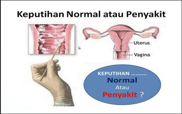 Keputihan Encer Seperti Air Saat Hamil Muda By Obat Keputihan Alami Medium