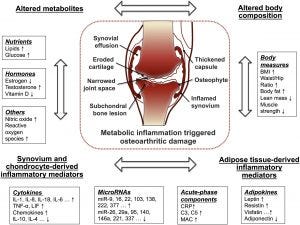 Exercise and Osteoarthritis: Science says stay active.