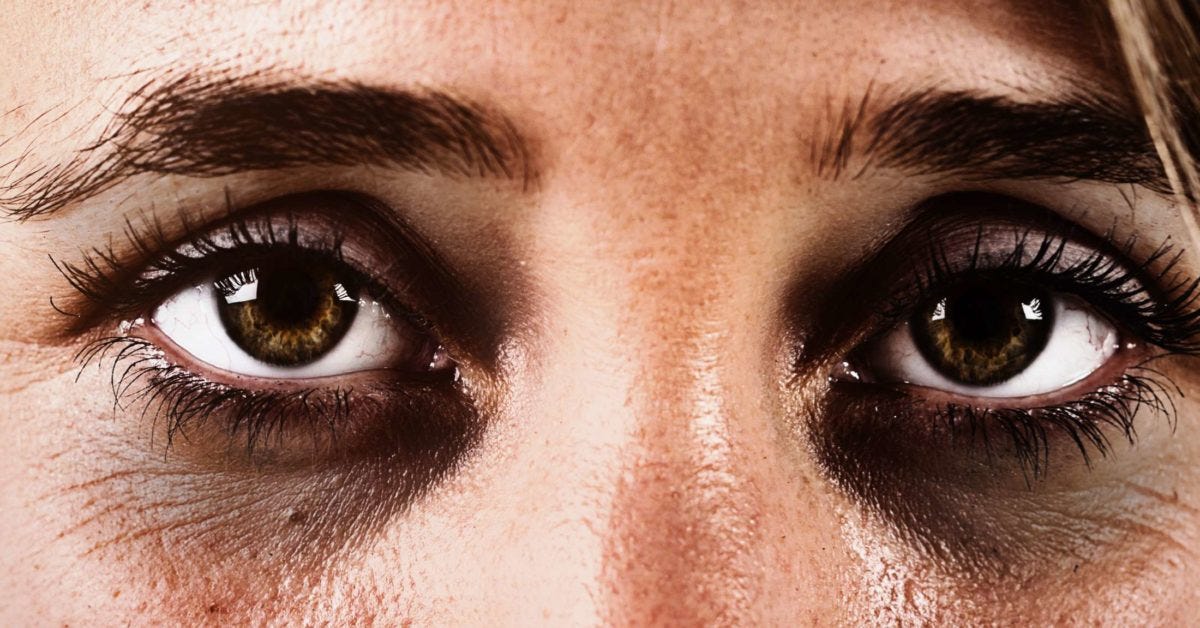 Do You Have Dark Circles Here Is How To Get Rid Of It By Karan Kumar Data Driven Investor Medium do you have dark circles here is how