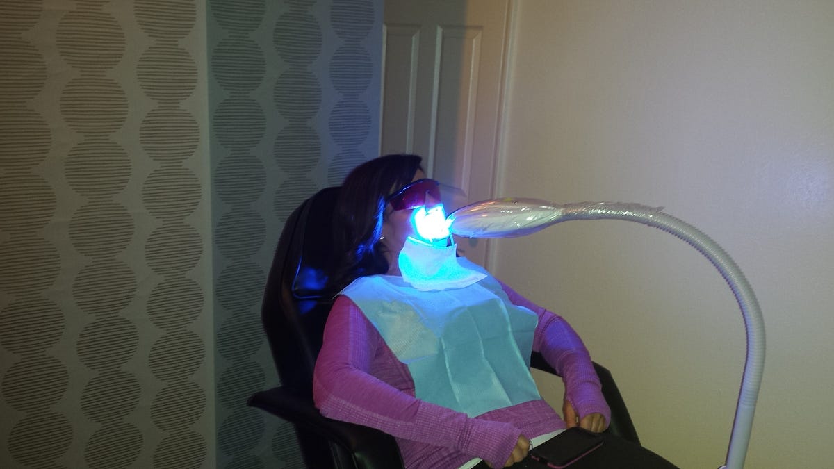 How to Maximize your Cosmetic Teeth Whitening Session by SmileLabs of