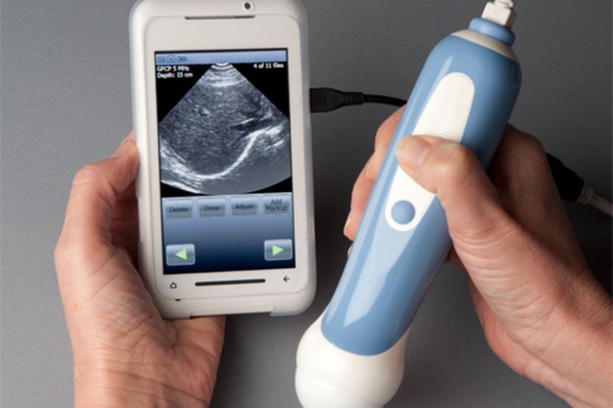 Know All About the Handheld Ultrasound Device Arshad Amin Medium