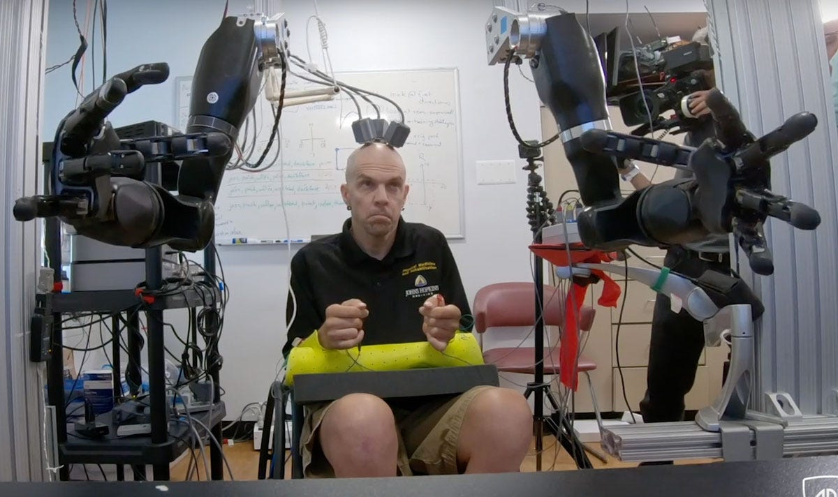 This man is learning to move two prosthetic arms directly, by thought alone...