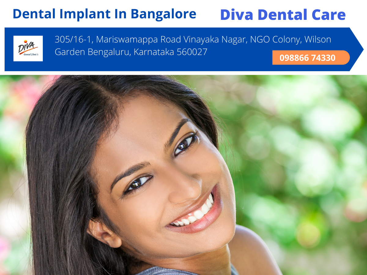 Dental Implant In Bangalore Implant Dentist Diva Dental Clinic By Flower Loverr Medium