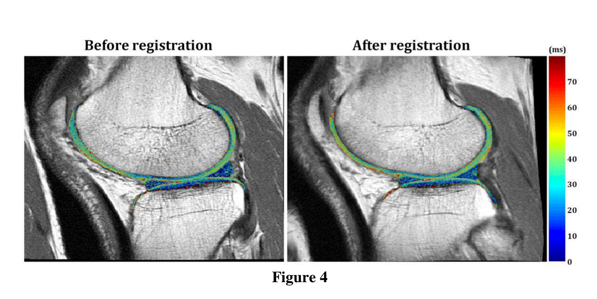 Finding Arthritis, Breast Cancer Diagnosis with Ultrasound, and
