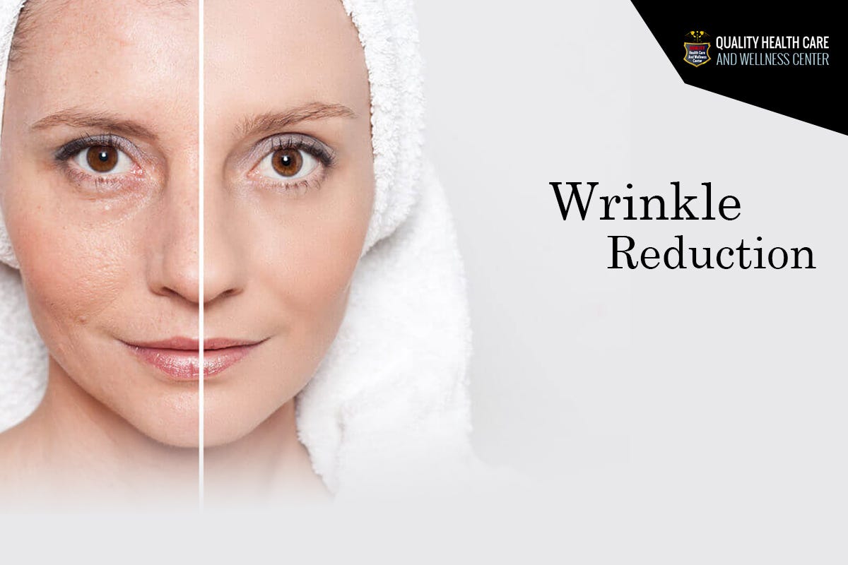 Sign of Aging: Wrinkles