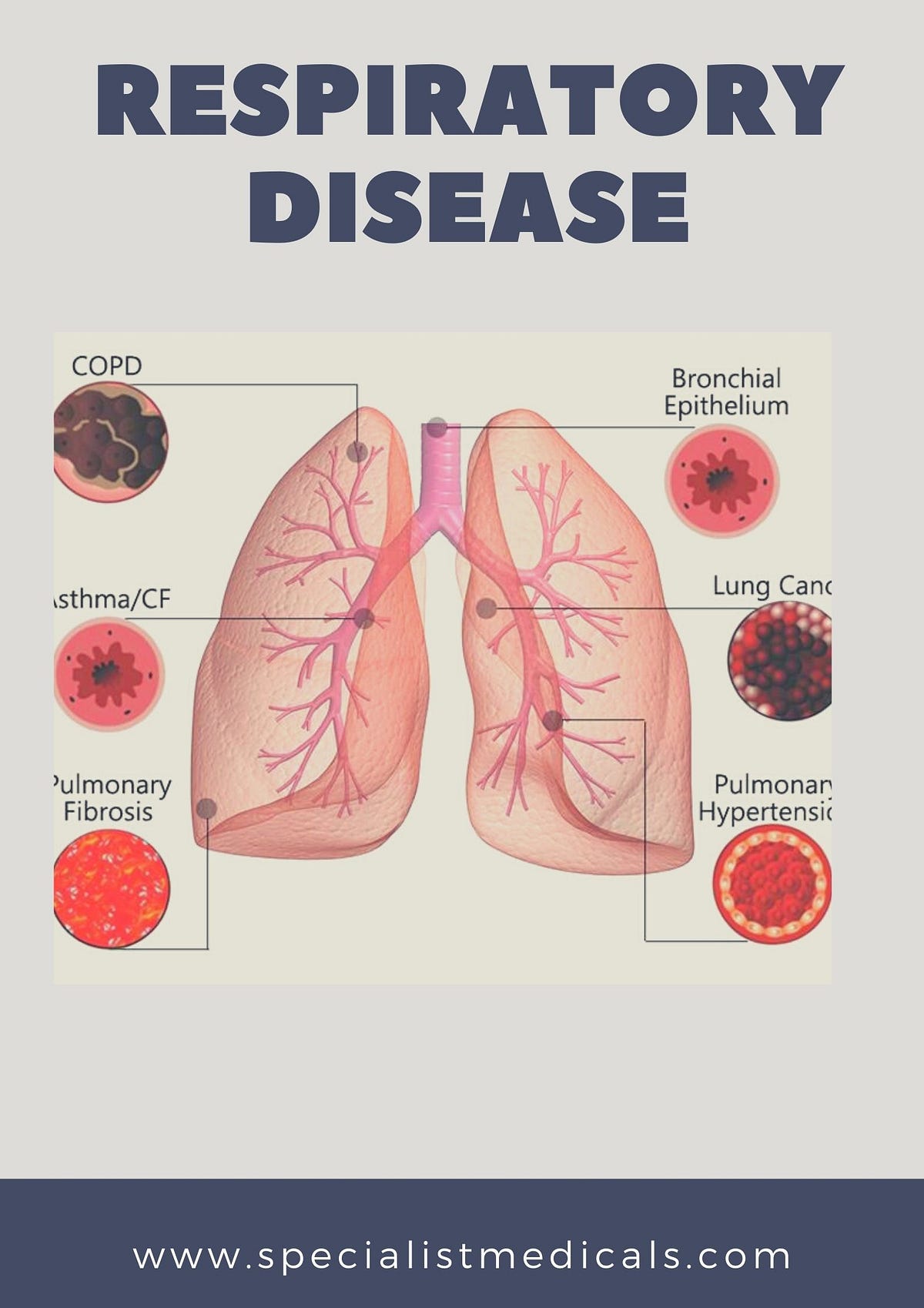 Symptoms of Respiratory Diseases and Disorders - Specialist Medicals ...