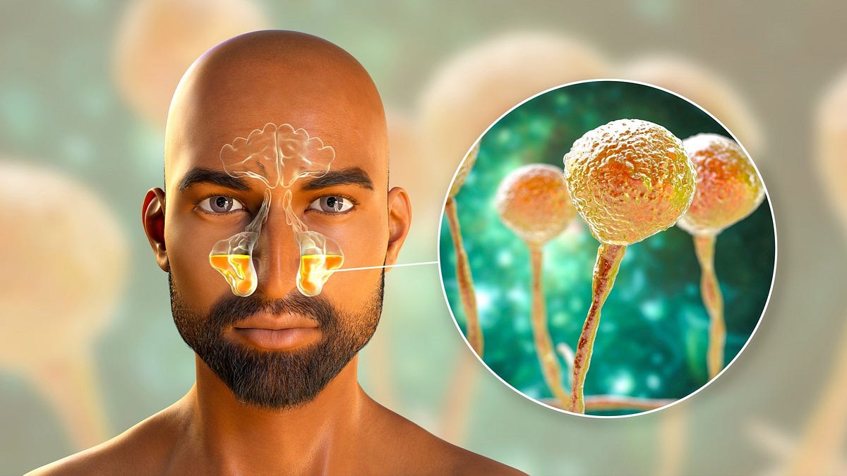 What is Black Fungus or Mucormycosis? — Black Fungus Symptoms and