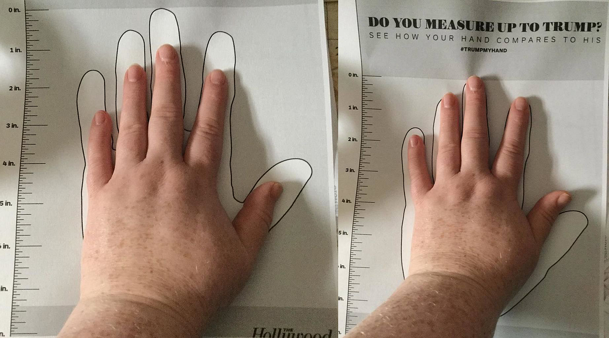 In Defense of Small Hands. Not everyone with tiny hands is as… by