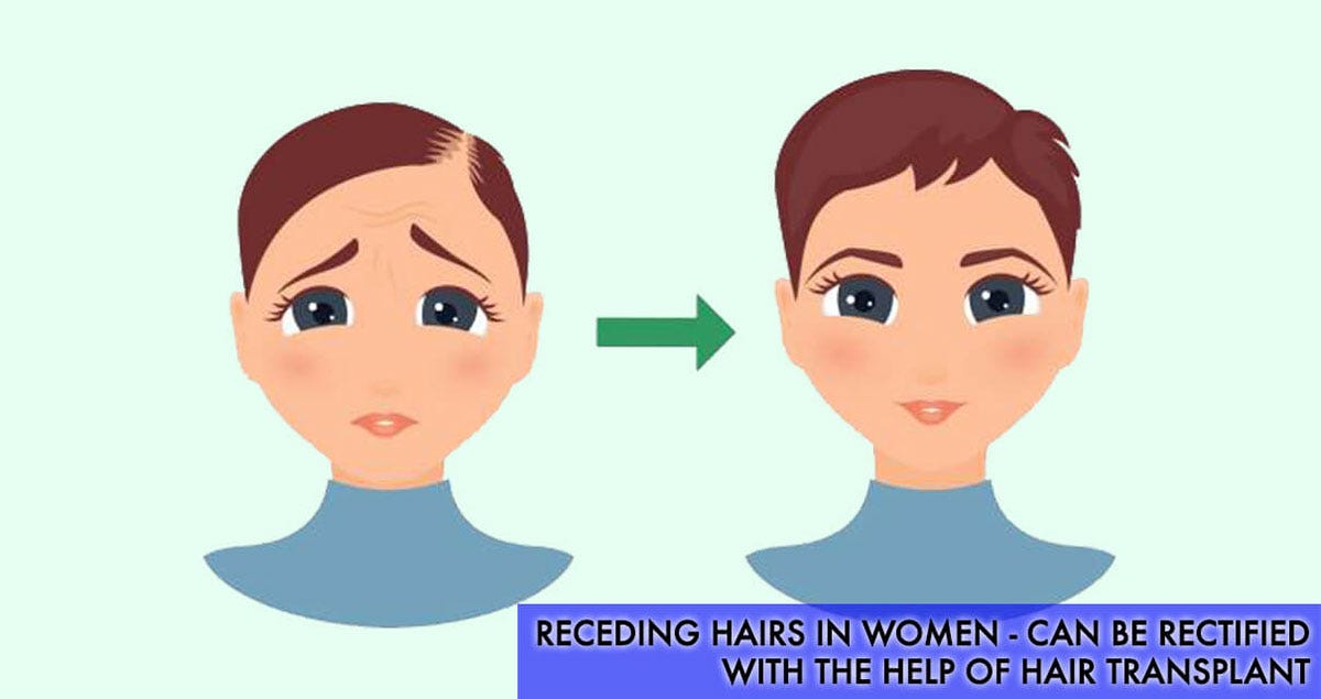 Receding Hairs In Women Can Be Rectified With The Help Of Hair