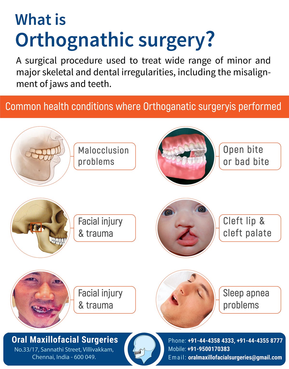 What is Orthognathic Surgery?. A Surgical procedure used to treat wide